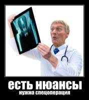 есть нюансы